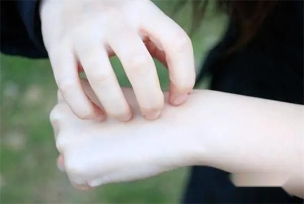 皮肤先知？皮肤和健康有关，怎么看皮肤上出现的那些异常？