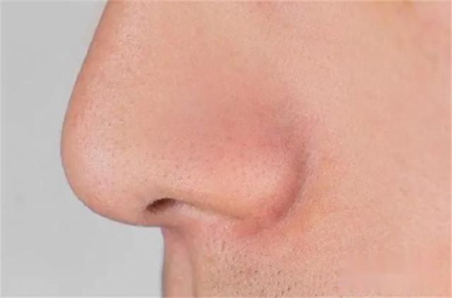 一到晚上就口干、口苦，别光顾着喝水！应警惕4种疾病