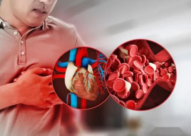 晚上睡不着是不是抑郁了