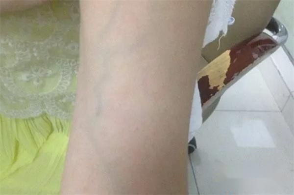 肝主筋，养肝先养筋，筋是什么？如何养筋？